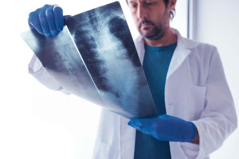 Doctor examining human x-ray of the human spine